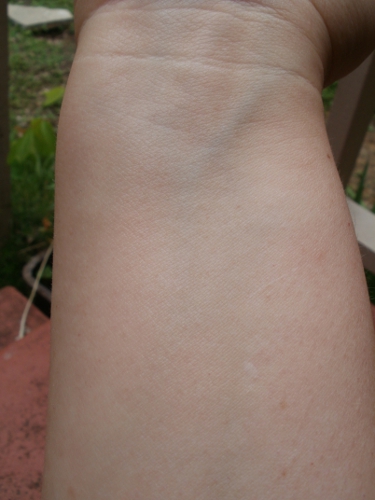 Same conditions; inside of forearm